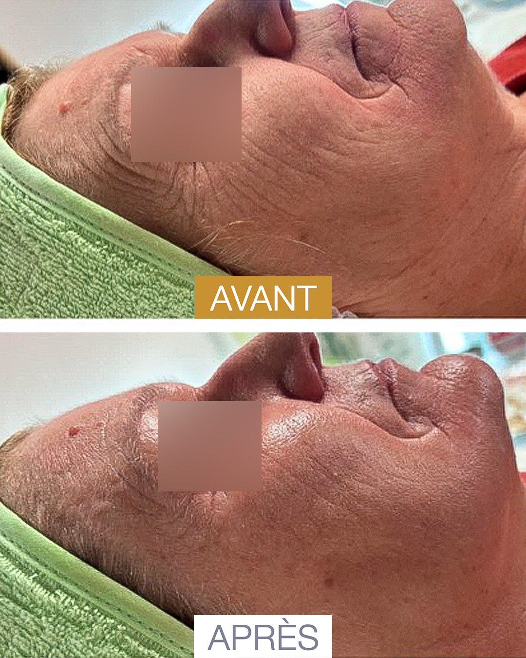 Soin Visible Age Reverse